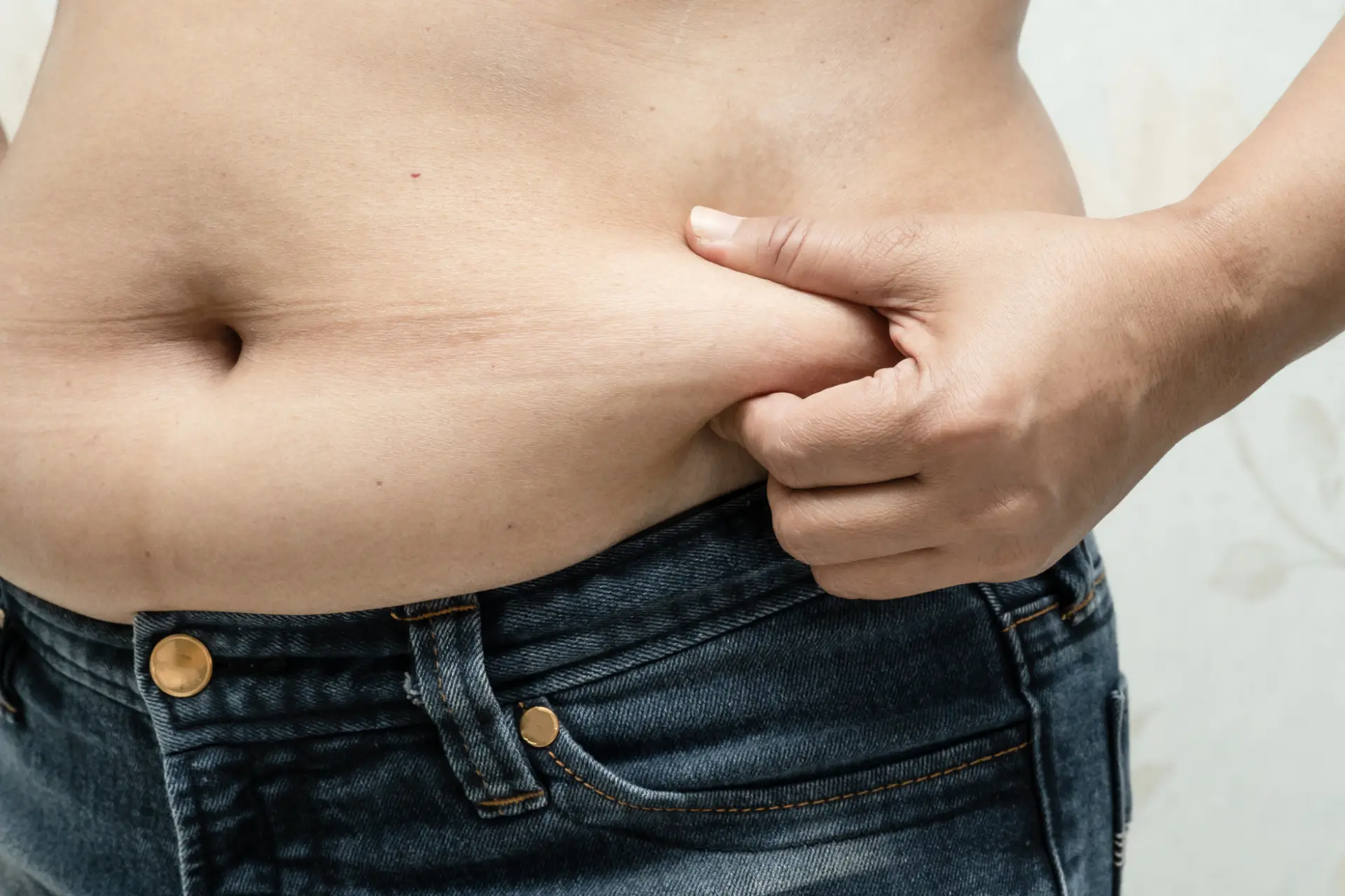 Abdominoplastia: o que você precisa saber antes de fazer essa cirurgia